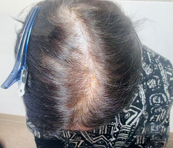 63歳女性